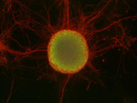 Green-stained embryonic stem cell colony surrounded by differntiated neurons (red)